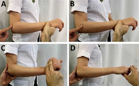 radial nerve compression test|radial nerve compression test assessment.